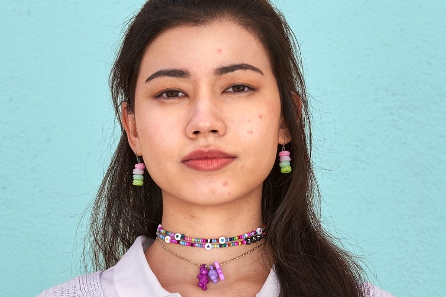 Adolescente asiática com espinhas no rosto usando brincos de macarons coloridos. 