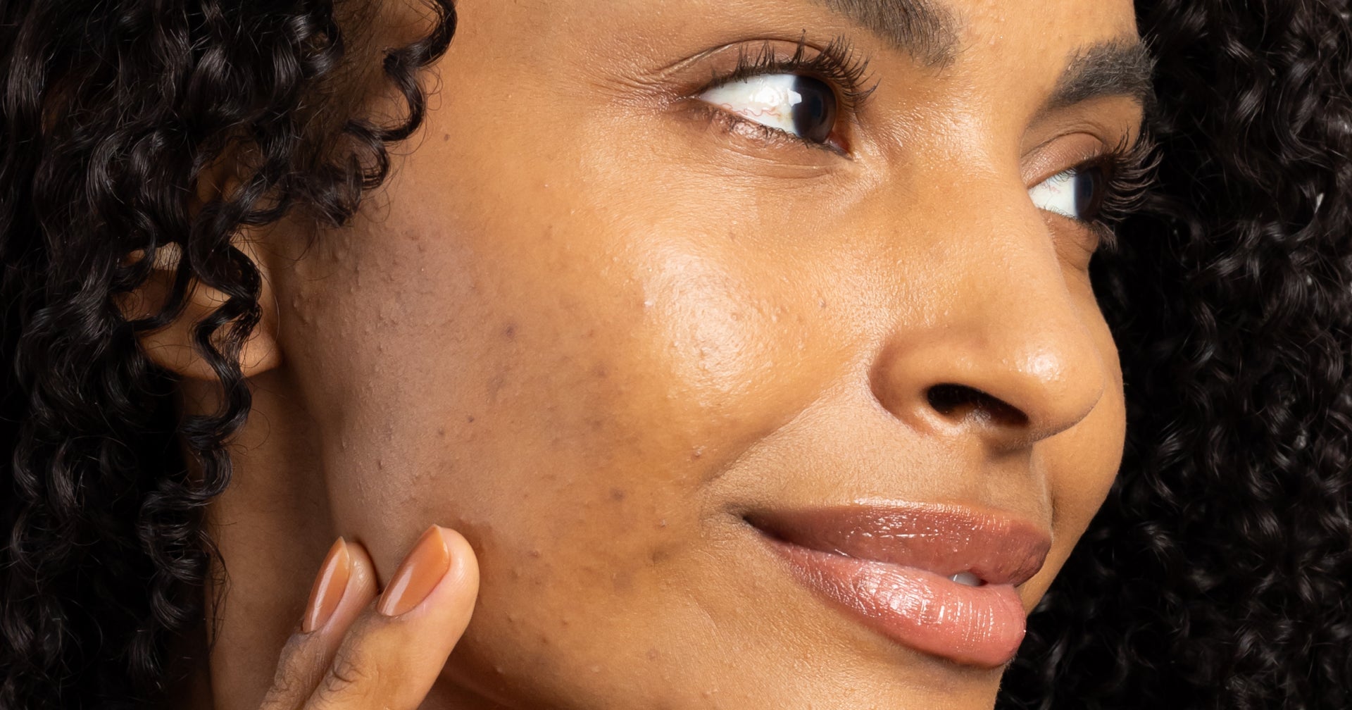 Close-up do rosto de uma mulher negra com pele acneica. Ela sorri suavemente, seus lábios brilhantes realçados por um batom nude ou gloss. Seus cabelos cacheados escuros emolduram o rosto, enquanto sua mão delicadamente toca sua face, com unhas pintadas em um tom laranja.